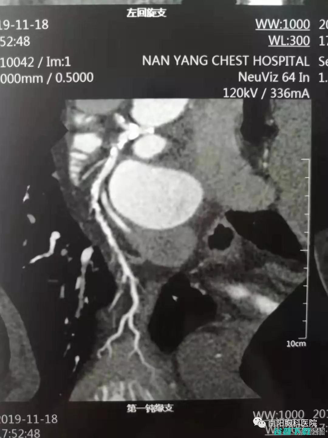 但看到检测结果直捶大腿…… 醉驾司机坚称只喝了一瓶半啤酒 (检测结果显示)